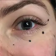 左眉上部有一颗大痣右边眉毛中间有一个小黑点这个痣和黑点是否代表不好的事情？如果是的话应该如何处理呢？