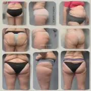 哪些因素可能导致一个女人拥有大而丰满的臀部而不是瘦弱的小臀部？