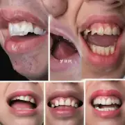 咬伤是否与口腔疾病有关联?