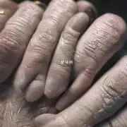 手指尖上有什么特殊的纹理吗?