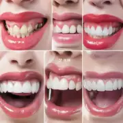 有哪些非手术治疗方法可以增大嘴巴容积?