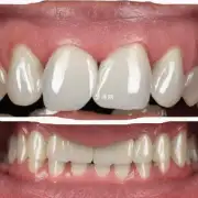 使用牙齿美白剂对扩大口腔有任何影响吗?